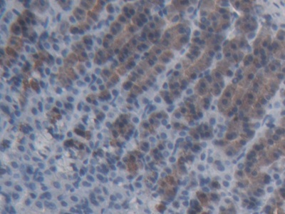 ATP Binding Cassette Transporter C11 (ABCC11) Rat Polyclonal Antibody