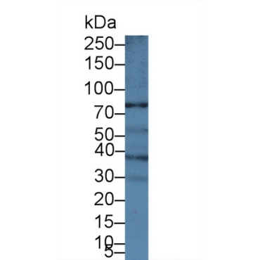 ATP Binding Cassette Transporter B5 (ABCB5) Human Polyclonal Antibody