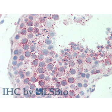 ATP Binding Cassette Transporter B6 (ABCB6) Human Polyclonal Antibody