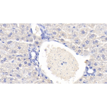 ATP Binding Cassette Transporter B7 (ABCB7) Mouse Polyclonal Antibody