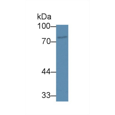 ATP Binding Cassette Transporter B8 (ABCB8) Human Polyclonal Antibody