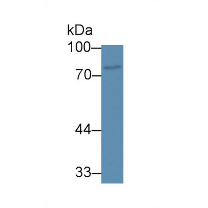 ATP Binding Cassette Transporter B8 (ABCB8) Human Polyclonal Antibody