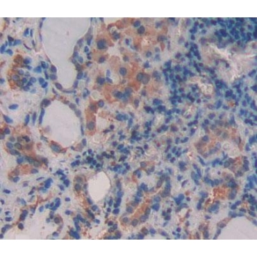 ATP Binding Cassette Transporter B9 (ABCB9) Human Polyclonal Antibody