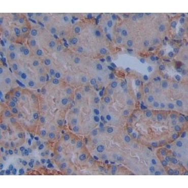 ATP Binding Cassette Transporter B10 (ABCB10) Mouse Polyclonal Antibody