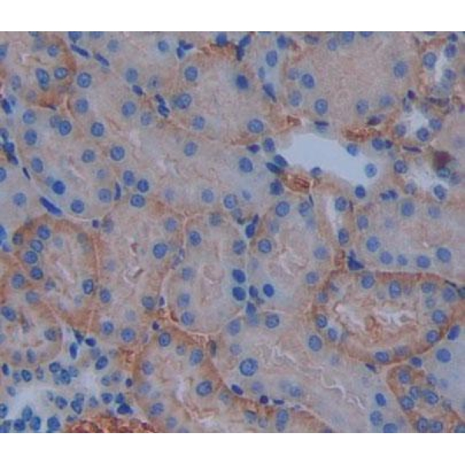 ATP Binding Cassette Transporter B10 (ABCB10) Mouse Polyclonal Antibody