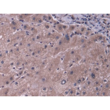 ATP Binding Cassette Transporter B11 (ABCB11) Human Polyclonal Antibody