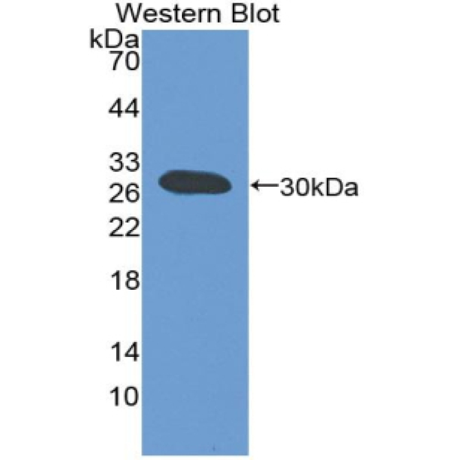 ATP Binding Cassette Transporter B11 (ABCB11) Mouse Polyclonal Antibody