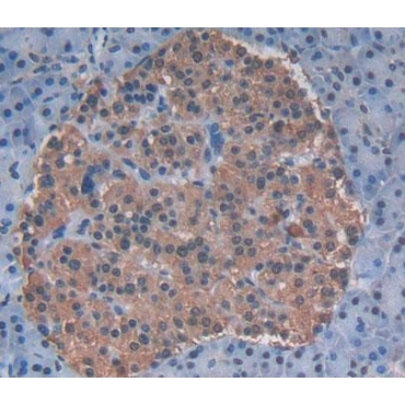 ATP Binding Cassette Transporter F2 (ABCF2) Human Polyclonal Antibody