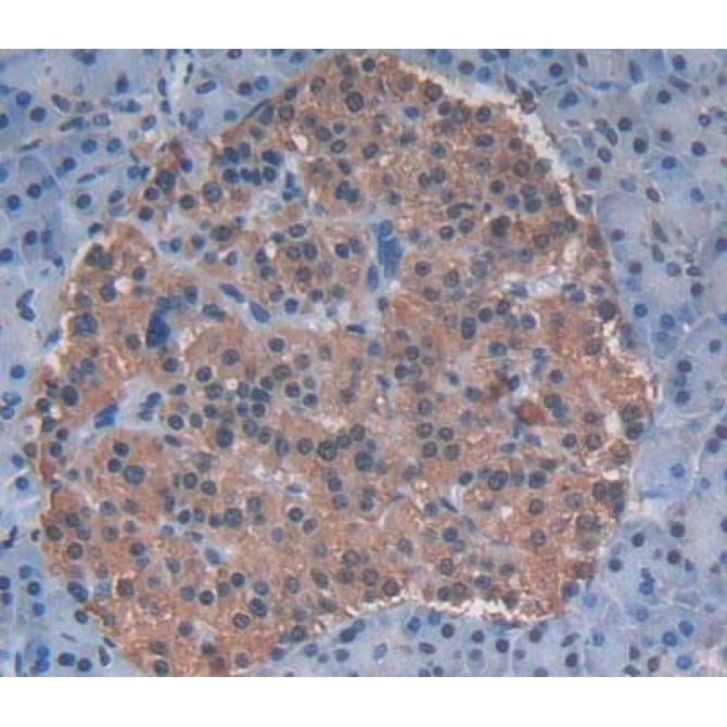 ATP Binding Cassette Transporter F2 (ABCF2) Human Polyclonal Antibody