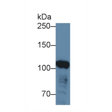 ATP Binding Cassette Transporter F1 (ABCF1) Human Polyclonal Antibody