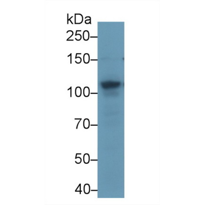 ATP Binding Cassette Transporter F1 (ABCF1) Mouse Polyclonal Antibody