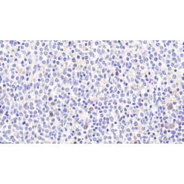 ATP Binding Cassette Transporter A7 (ABCA7) Human Polyclonal Antibody