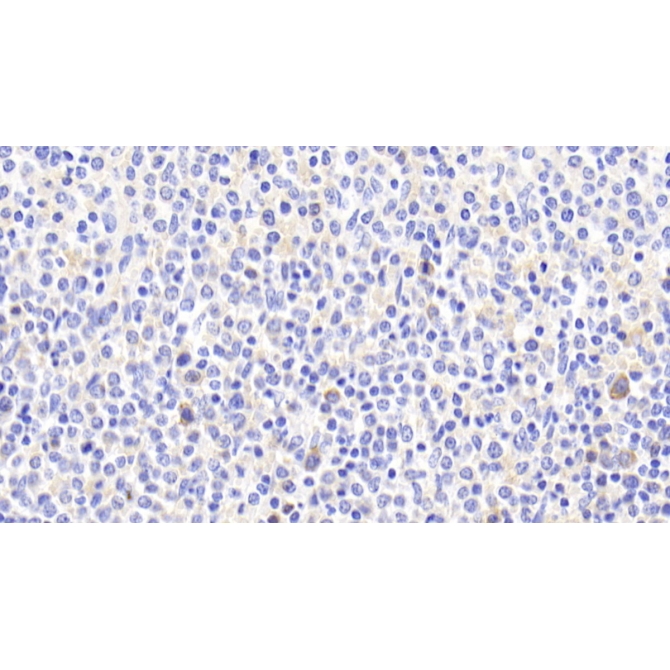ATP Binding Cassette Transporter A7 (ABCA7) Human Polyclonal Antibody