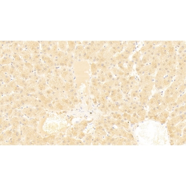 ATP Binding Cassette Transporter A8 (ABCA8) Human Polyclonal Antibody