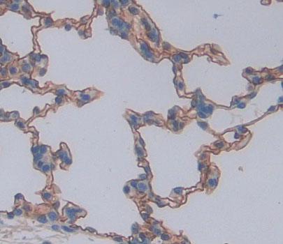 ATP Binding Cassette Transporter A8 (ABCA8) Rat Polyclonal Antibody