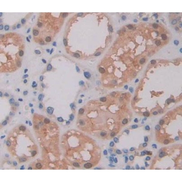 ATP Binding Cassette Transporter A9 (ABCA9) Human Polyclonal Antibody