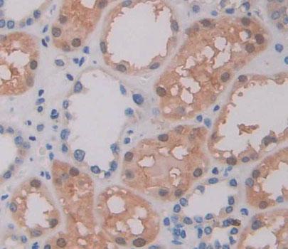 ATP Binding Cassette Transporter A9 (ABCA9) Human Polyclonal Antibody