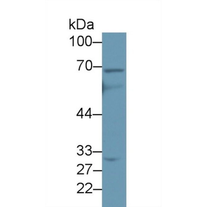 ATP Binding Cassette Transporter D4 (ABCD4) Human Polyclonal Antibody