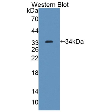 ATP Binding Cassette Transporter G8 (ABCG8) Mouse Polyclonal Antibody