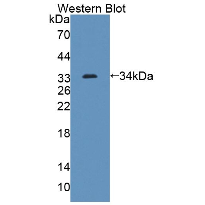 ATP Binding Cassette Transporter G8 (ABCG8) Mouse Polyclonal Antibody