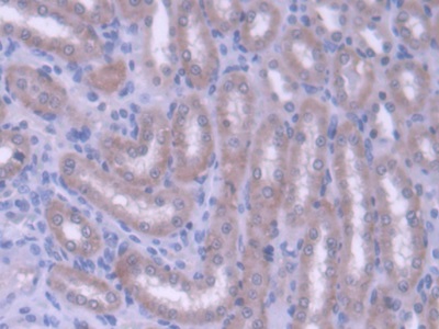 ATP Binding Cassette Transporter G8 (ABCG8) Rat Polyclonal Antibody