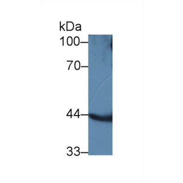 Acyl Coenzyme A Dehydrogenase, Long Chain (ACADL) Human Polyclonal Antibody