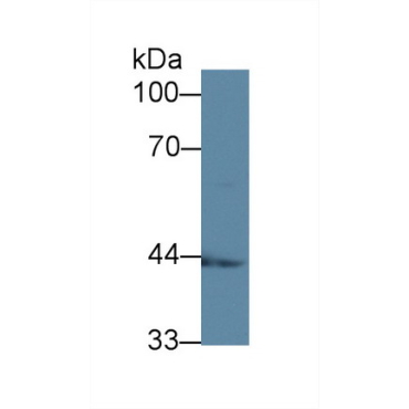 Acyl Coenzyme A Dehydrogenase, C2-To-C3 Short Chain (ACADS) Human Polyclonal Antibody