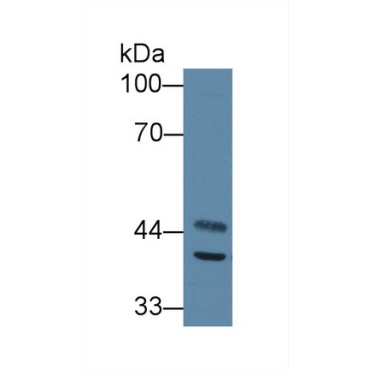 Acyl Coenzyme A Dehydrogenase, C2-To-C3 Short Chain (ACADS) Mouse Polyclonal Antibody