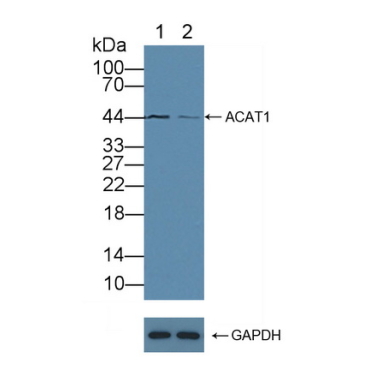 Acetyl Coenzyme A Acetyltransferase 1 (ACAT1) Human Polyclonal Antibody