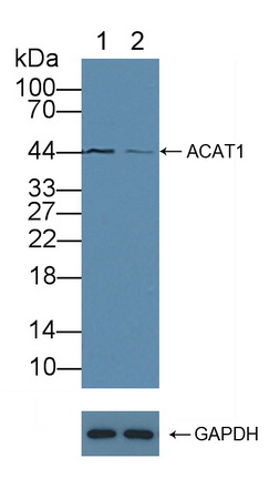 Acetyl Coenzyme A Acetyltransferase 1 (ACAT1) Human Polyclonal Antibody