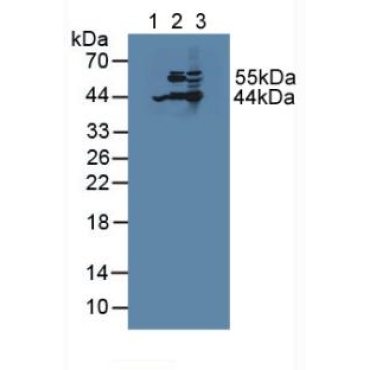 Acetyl Coenzyme A Acetyltransferase 2 (ACAT2) Human Polyclonal Antibody