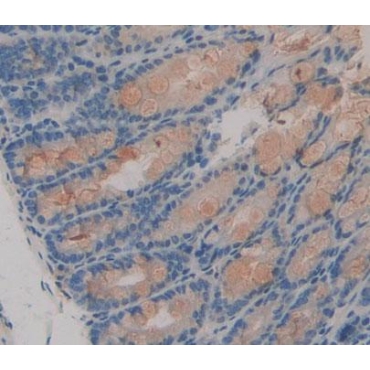 Coenzyme A Synthase (COASY) Mouse Polyclonal Antibody