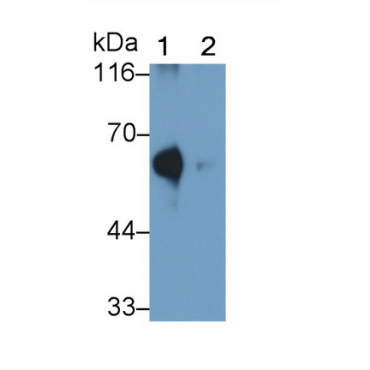 Acyl Coenzyme A Synthetase Medium Chain Family, Member 1 (ACSM1) Human Polyclonal Antibody