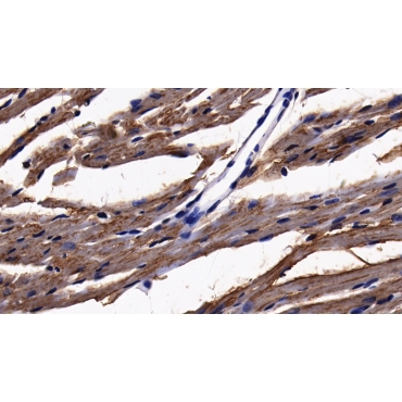 Acyl Coenzyme A Synthetase Long Chain Family, Member 1 (ACSL1) Mouse Polyclonal Antibody