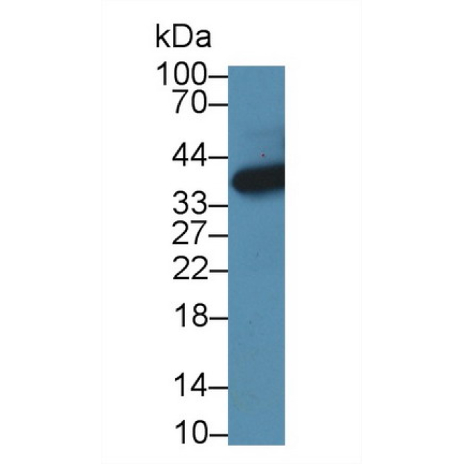 3-Hydroxyisobutyryl Coenzyme A Hydrolase (HIBCH) Mouse Polyclonal Antibody