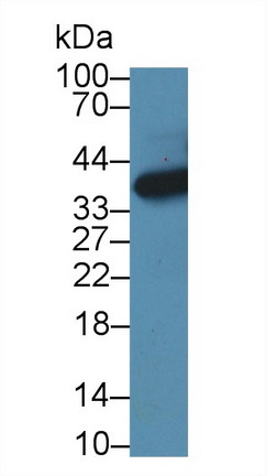 3-Hydroxyisobutyryl Coenzyme A Hydrolase (HIBCH) Mouse Polyclonal Antibody