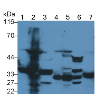 3-Hydroxymethyl-3-Methylglutaryl Coenzyme A Lyase (HMGCL) Human Polyclonal Antibody