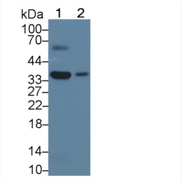 3-Hydroxymethyl-3-Methylglutaryl Coenzyme A Lyase (HMGCL) Mouse Polyclonal Antibody