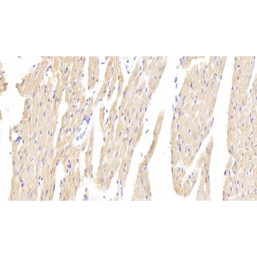 3-Hydroxy-3-Methylglutaryl Coenzyme A Reductase (HMGCR) Human Polyclonal Antibody