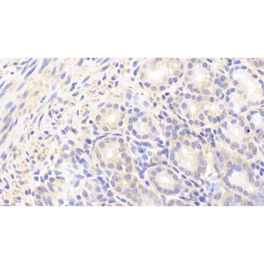 Methylcrotonoyl Coenzyme A Carboxylase 2 (MCCC2) Human Polyclonal Antibody