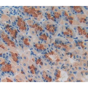 Methylcrotonoyl Coenzyme A Carboxylase 2 (MCCC2) Mouse Polyclonal Antibody