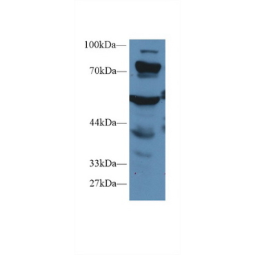 Propionyl Coenzyme A Carboxylase Alpha (PCCa) Human Polyclonal Antibody