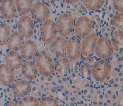 Propionyl Coenzyme A Carboxylase Beta (PCCb) Mouse Polyclonal Antibody