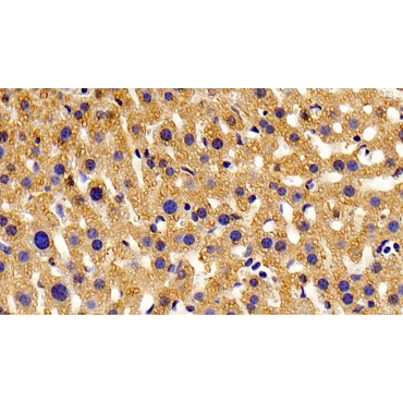 Peroxisomal D3, D2-Enoyl Coenzyme A Isomerase (PECI) Mouse Polyclonal Antibody