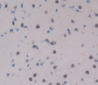 Peroxisomal D3, D2-Enoyl Coenzyme A Isomerase (PECI) Rat Polyclonal Antibody
