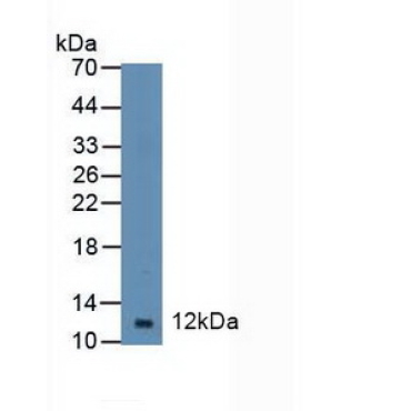 Diazepam Binding Inhibitor (DBI) Human Polyclonal Antibody
