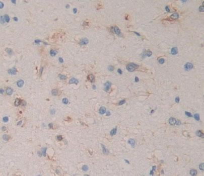 Regulator Of G Protein Signaling 9 (RGS9) Human Polyclonal Antibody