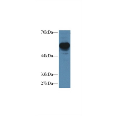 Regulator Of G Protein Signaling 7 (RGS7) Human Polyclonal Antibody