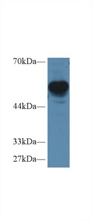 Regulator Of G Protein Signaling 7 (RGS7) Human Polyclonal Antibody