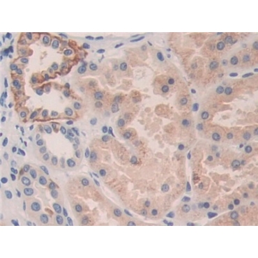 Killer Cell Immunoglobulin Like Receptor 2DL3 (KIR2DL3) Human Polyclonal Antibody